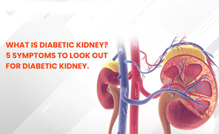 What is Diabetic kidney? 5 Symptoms to look out for Diabetic Kidney